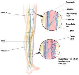 leg_veins_diagram